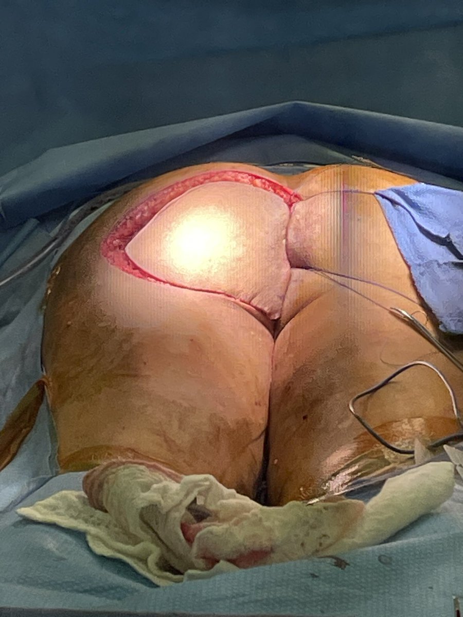 Humberto Villarreal, MD MSCI tweet media