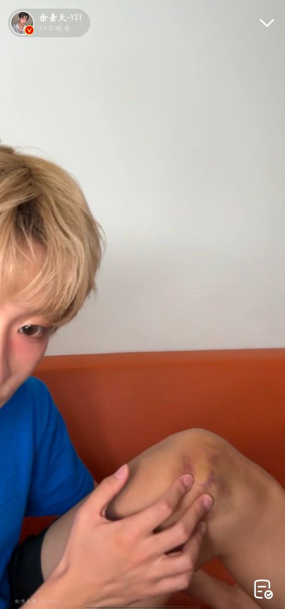 chocoLiu's tweet photo. 무릎이 너무심해요ㅠㅠ

#TONY #토니 https://t.co/kXCpuTl7qK