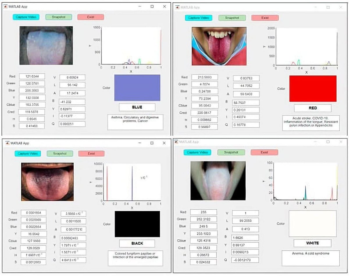 The Benefits of AI: Scientists Teach AI to Diagnose Diseases by Tongue Color

Professor Ali Al-Nadji from the Middle Technical University in Baghdad and his Australian colleagues uploaded 5,260 real images of tongues in different colors into a computer system. The system was then