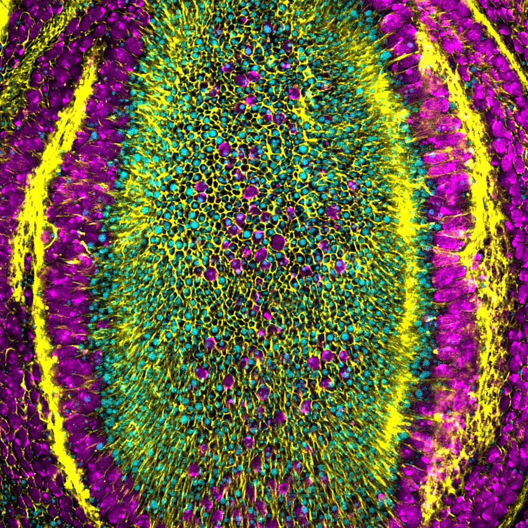 IRB Barcelona (@irbbarcelona) on Twitter photo 👀Check out our outstanding #ImageOfTheMonth!👇
👁️"The Eye of Sauron", by <a href="/KaustuvGhosh1/">Kaustuv Ghosh</a> & David Malpartida, from <a href="/MarcoMilanIRB/">Marco Milan</a> lab.
📸The image shows the pouch of the wing epithelial disc, which gives rise to the wings of adult #Drosophila flies.
Happy #September!🌞🍂 👀Check out our outstanding #ImageOfTheMonth!👇
👁️"The Eye of Sauron", by <a href="/KaustuvGhosh1/">Kaustuv Ghosh</a> & David Malpartida, from <a href="/MarcoMilanIRB/">Marco Milan</a> lab.
📸The image shows the pouch of the wing epithelial disc, which gives rise to the wings of adult #Drosophila flies.
Happy #September!🌞🍂