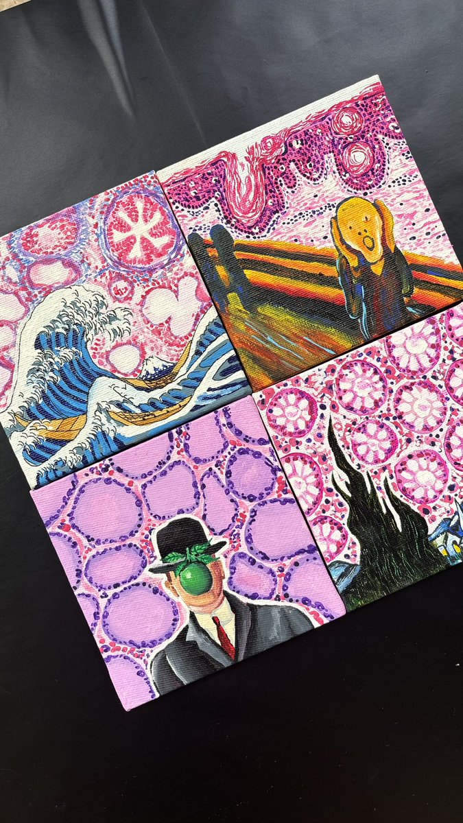 Blending classic paintings with pathology slides. Had this idea since a long time so I finally brought it to life🖼️🔬🎨
#pathart #pathtwitter #pathology #pathmatch2025