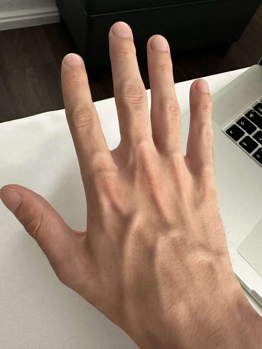 PhilippoMonster's tweet photo. @hyazinthsoul Hand ✋🏻 https://t.co/jnGxringMs