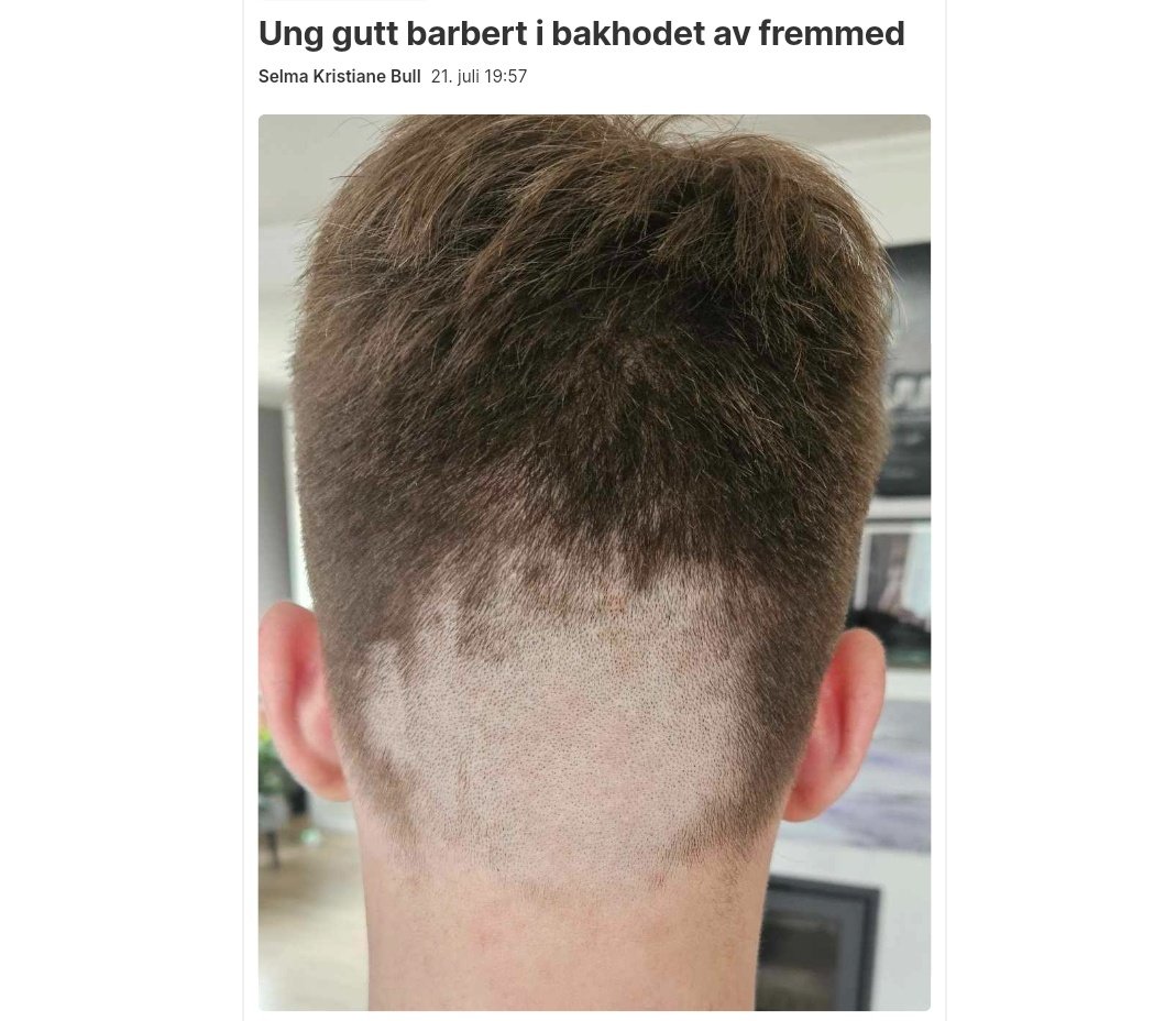 Saken ble henlagt da det i ettertid viste seg at gutten hadde hatt hockeysveis.