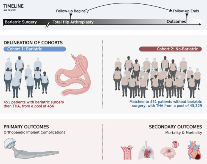 JArthroplasty's tweet photo. Obese patients who underwent bariatric surgery prior to THA experienced reduced medical complications at all time points and reduced rates of revision at 72 months relative to a matched cohort who did not undergo bariatric surgery.

https://t.co/DspYIWEdSM https://t.co/oan4SdVaqJ
