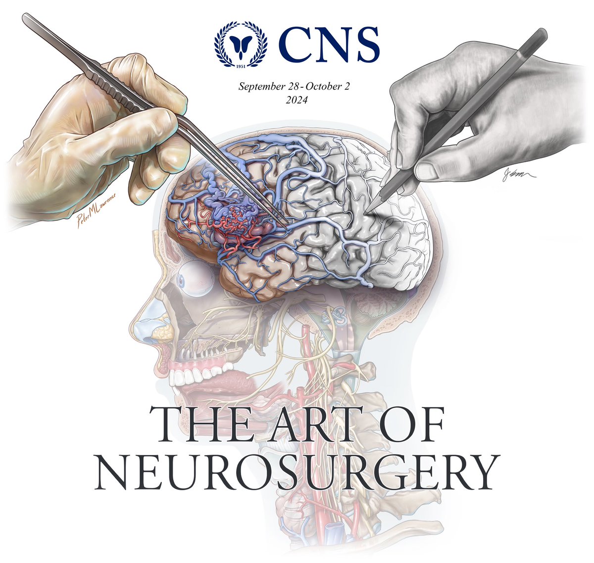 PeterMLawrence1's tweet photo. Excited to announce the "Art of Neurosurgery" program at @CNS_Update 2024! This year we will be displaying a large collection of art from medical illustrators and neurosurgeons, doing live demos of 2D &amp; 3D art, and having guest speakers present on innovations in neuro education https://t.co/oaFhRKrvrV