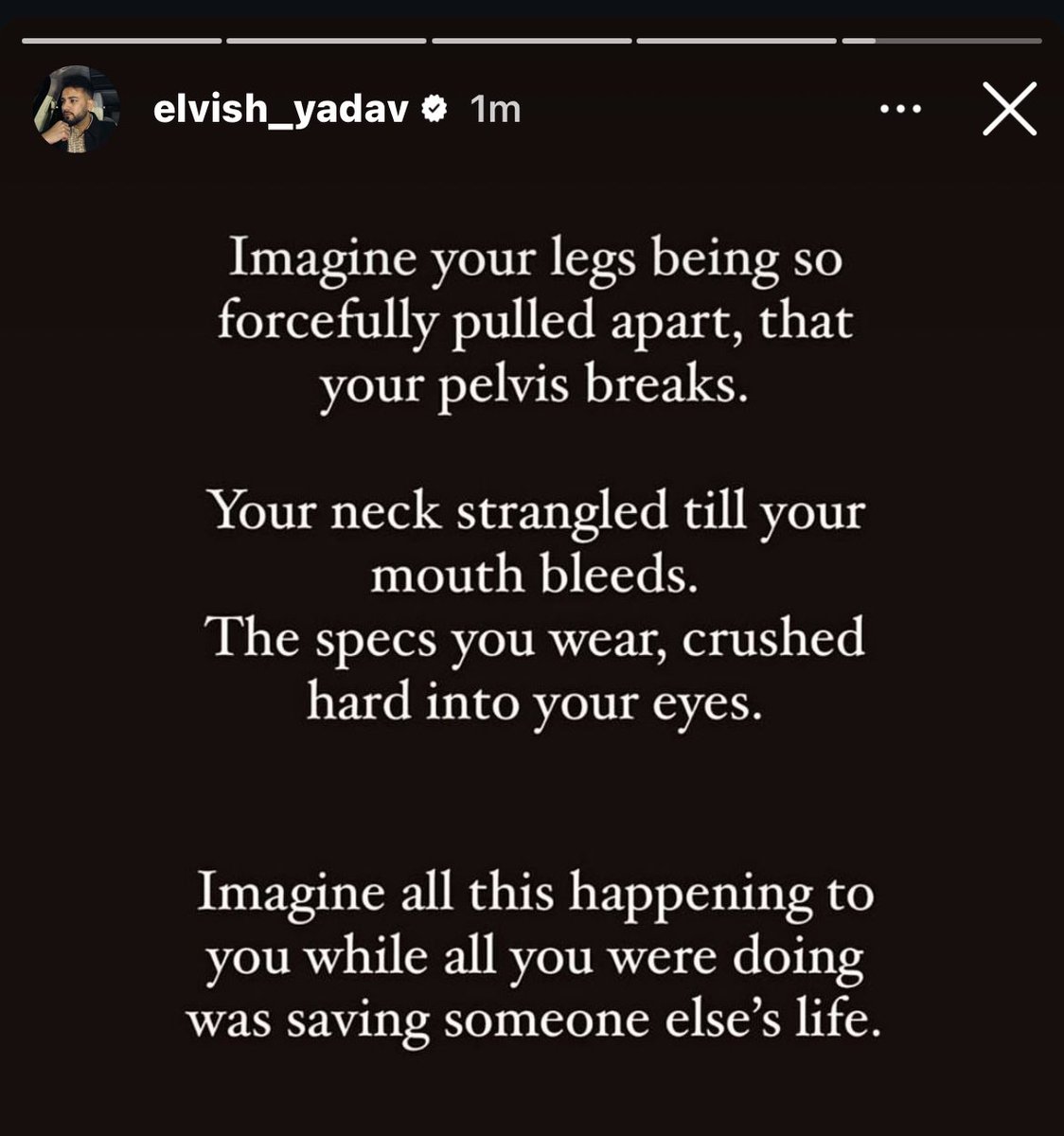 Nikhil_paliwal0's tweet image. Thank you for always taking the stand !!
Proud you of @ElvishYadav ❤️🫂
#ElvishYadav #ElvishArmy𓃵