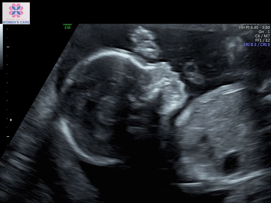 lzzzrdqueen's tweet photo. Life update #preg https://t.co/pngNyhJNjY
