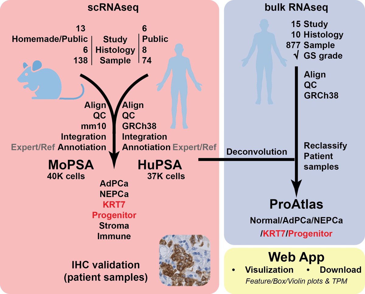 Siyuan Cheng, PhD (@chengsiyuan1004) on Twitter photo I am thrilled that our scRNAseq study on prostate cancer is published! We identified two novel cancer subtypes: KRT7 and progenitor-like and developed webApp. Check it out here: rdcu.be/dPONB <a href="/Nature_NPJ/">npj Journals</a>. Explore the data: pcatools.shinyapps.io/HuPSA-MoPSA/ <a href="/LSUHS/">LSU Health Shreveport</a> @NCICancerBio I am thrilled that our scRNAseq study on prostate cancer is published! We identified two novel cancer subtypes: KRT7 and progenitor-like and developed webApp. Check it out here: rdcu.be/dPONB <a href="/Nature_NPJ/">npj Journals</a>. Explore the data: pcatools.shinyapps.io/HuPSA-MoPSA/ <a href="/LSUHS/">LSU Health Shreveport</a> @NCICancerBio