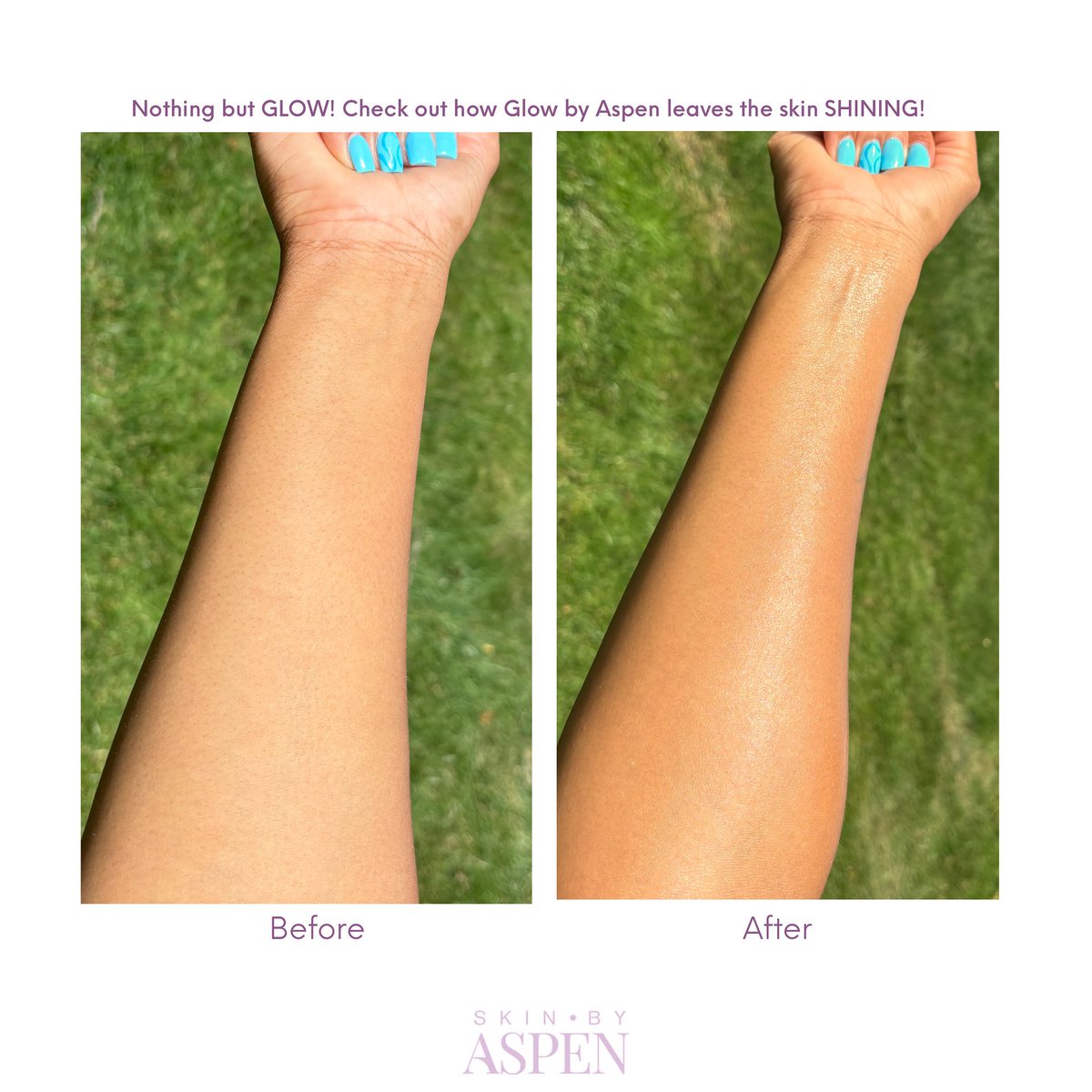 skinbyaspen's tweet photo. NOTHING BUT GLOW ✨

Look at this amazing Before &amp; After of our Glow by Aspen  Suntan Oil! 

Our hydrating formulas deliver deep nourishment, leaving your skin radiant, refreshed, and ready to glow all summer long!

Shop today at https://t.co/hvubzci1mM https://t.co/zDjJ1yBJ5N
