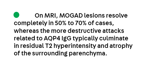 Key Point 1 from the article NMOSD and MOGAD by Dr. Elia Sechi from the August Autoimmune Neurology issue, which is available to all at journals.lww.com/continuum/full…. <a href="/EliaSechi/">Elia Sechi</a> 
#Neurology #NeuroTwitter #MedEd