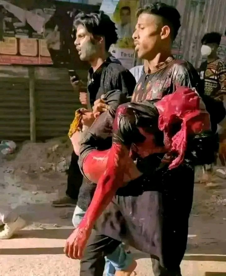 Kimjanntt's tweet photo. @dhruvrahtee @elonmusk Thank you so much for your supporting. Today they killed our 6 brothers. Also Indian raw agent is here. They are also killing our people 🙂. I don't know why modi help sheik hasina? Why he send the Raw agent here? What's his motive? https://t.co/xL4tWal1rw