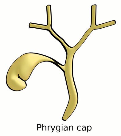Flavio G Rocha, MD, FACS, FSSO tweet media