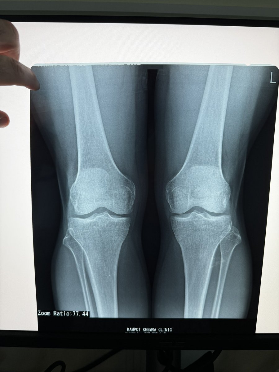 Jacob in Cambodia 🇺🇸 🇰🇭 tweet media