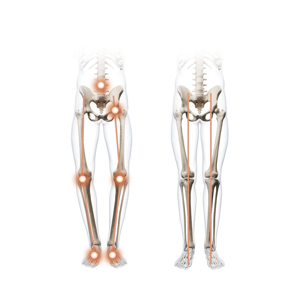 TheGoodFeetCOS's tweet image. Back pain. Knee Pain. Foot pain. Hip pain. If you experience any of these, come into the Good Feet store for custom-fitted arches and orthotics to get some real relief! 

#thegoodfeetstore #goodfeetstore #coloradosprings #pueblo #archsupports #plantarfasciitis #fasciitis #knee...