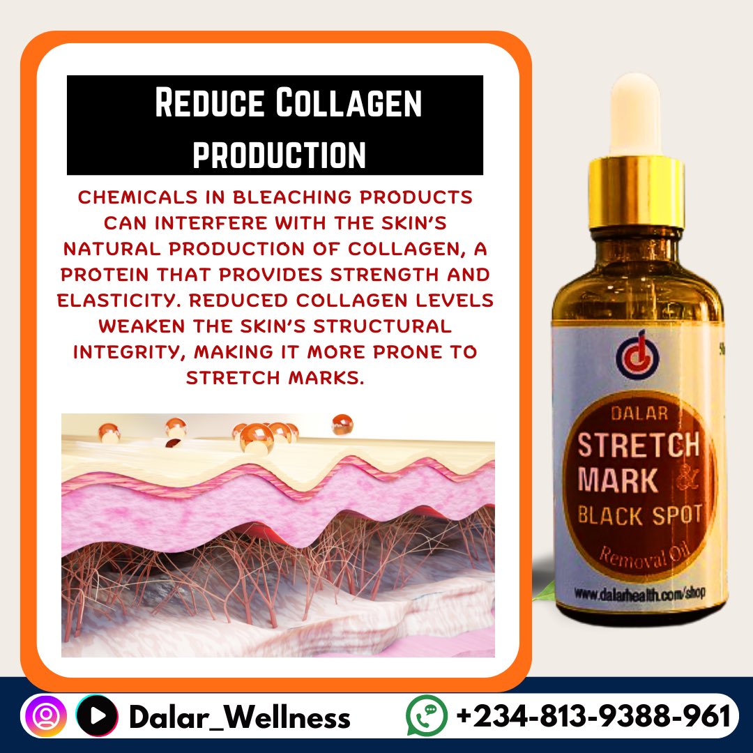 dalarskincare's tweet photo. Did you know that skin bleaching can lead to stretch marks? Here's why👇
#stretchmarks https://t.co/nVUFMtQCIr