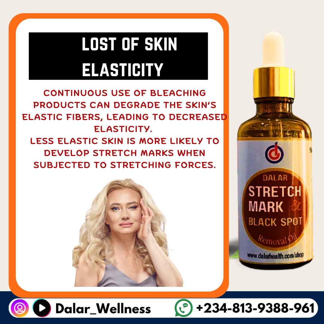 dalarskincare's tweet photo. Did you know that skin bleaching can lead to stretch marks? Here's why👇
#stretchmarks https://t.co/nVUFMtQCIr