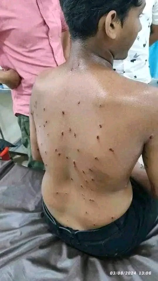 Troy_Shant's tweet photo. Death toll reached 13 in CUMILLA today
250+ are injured from the open fire and assault by Chhatra league goons and Police of the dictator Hasina

ALL EYES ON CUMILLA
STEP DOWN FASCIST HASINA 
 
#StepDownHasina
#StudentsUnderAttack
#SaveBangladeshiStudents https://t.co/4VqIikPi0Z