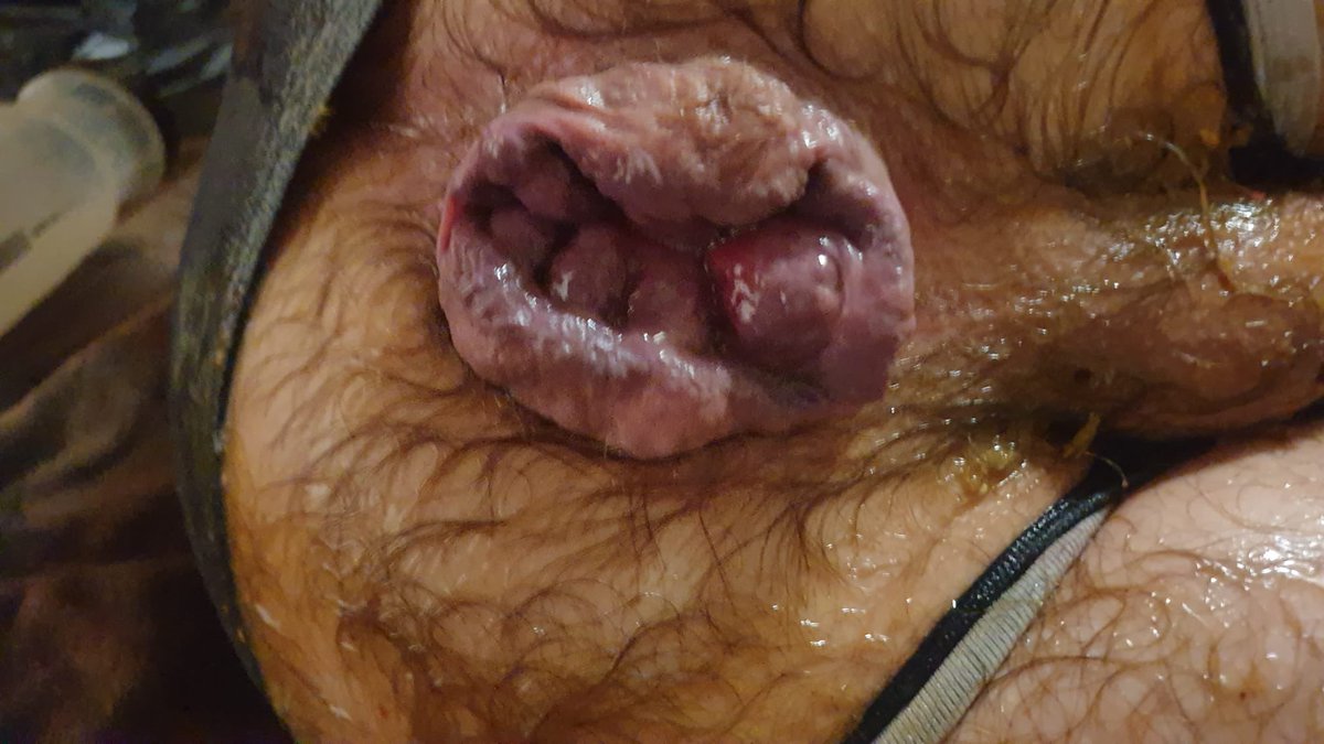 it can be better! #asswork #rosebudd #rondelle #fist #gayfist