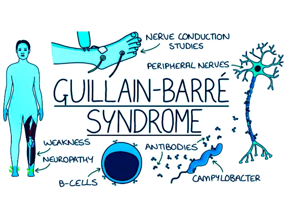 Sine Aras Akten tweet media