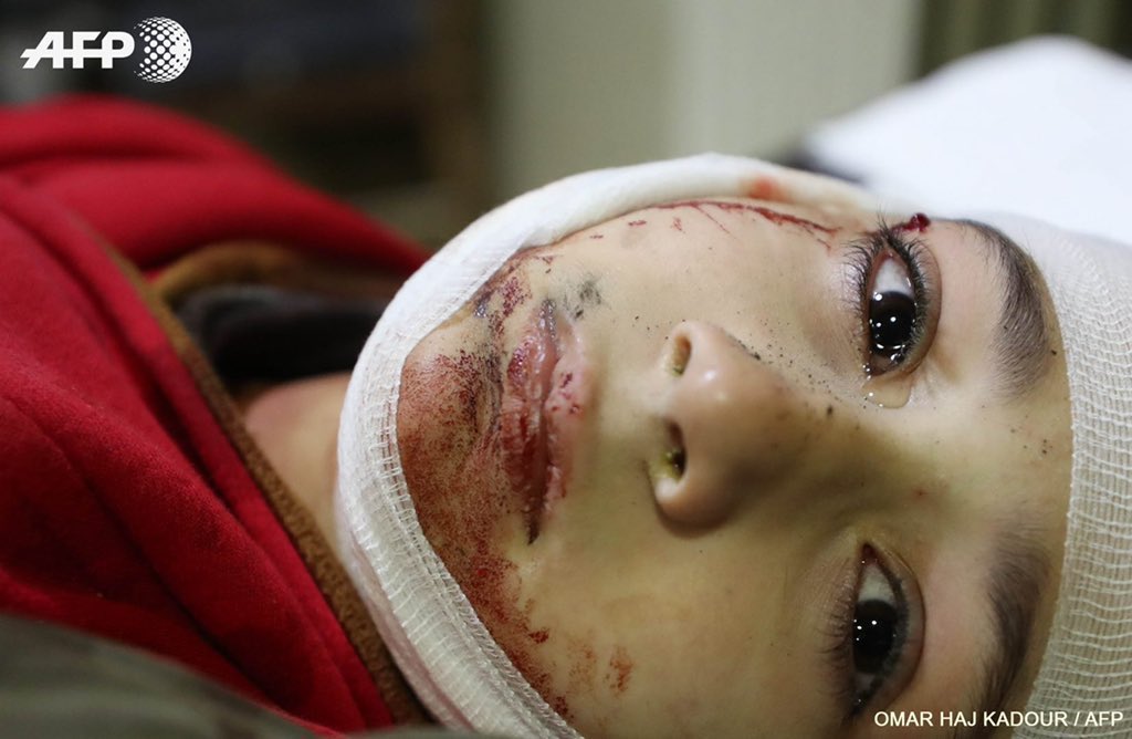 Sağ kalan bir yana şehit edilenler bile ümmmetin yolunu gözlerken ağladı!
#GazzeDirenişi 
#hamas
#ismailhaniye 
#iran 
#FilistinBizimDavamız