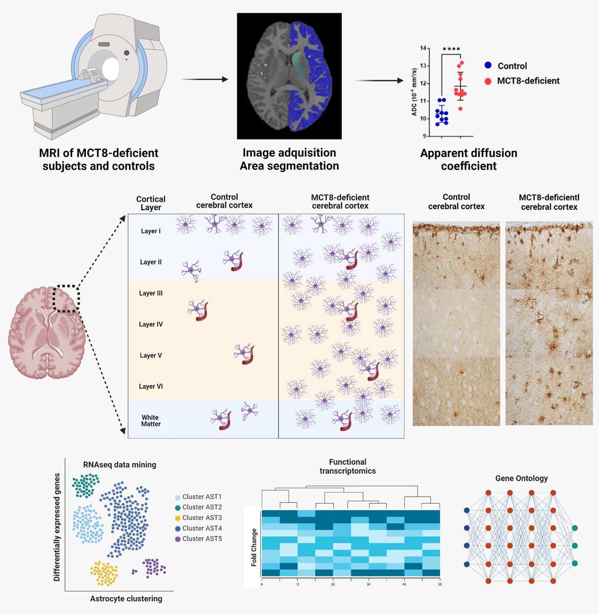 ThyroidLabIIBM's tweet photo. We are excited to share with you our latest publication: Defective thyroid hormone transport to the brain leads to astroglial alterations

https://t.co/uggjknpESE

Wanna join us into the ins and outs of this article? 
Follow this thread! 
🧵↘️⬇️↙️
@IIBmCSICUAM @CSICdivulga @SENC_ https://t.co/7tIOyrmxKM
