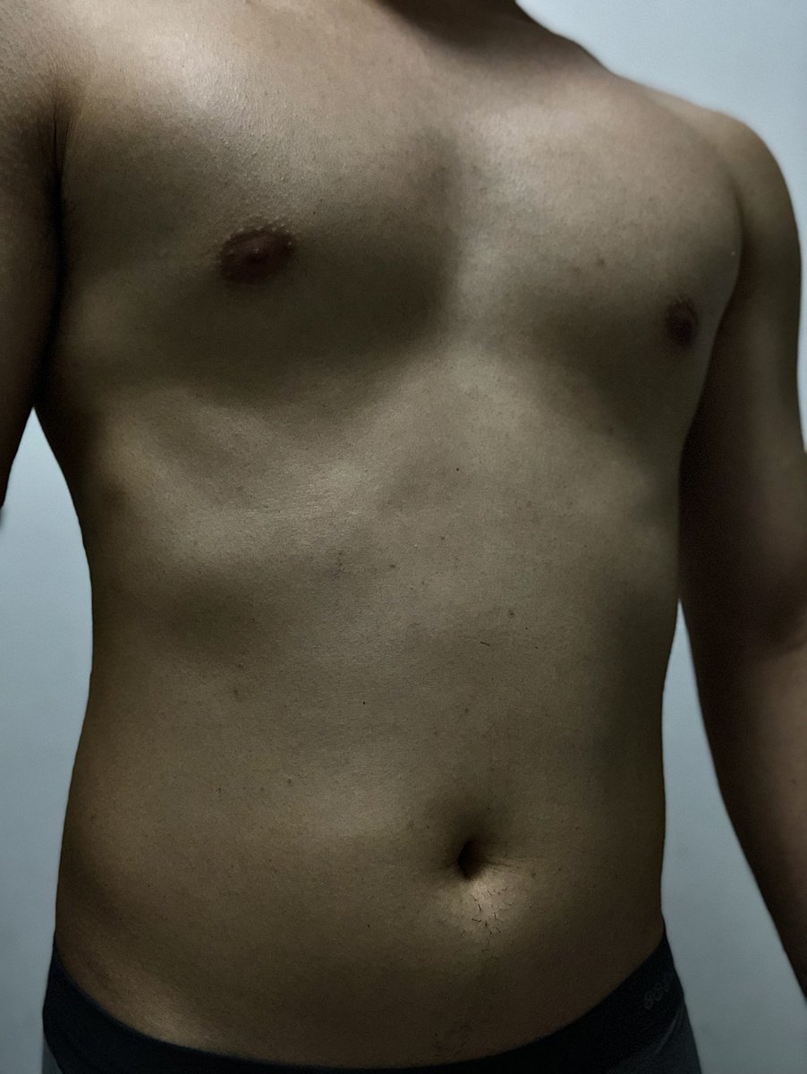 youlover tweet media