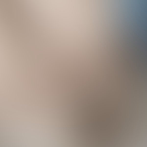 Dr. Glaucomflecken tweet media