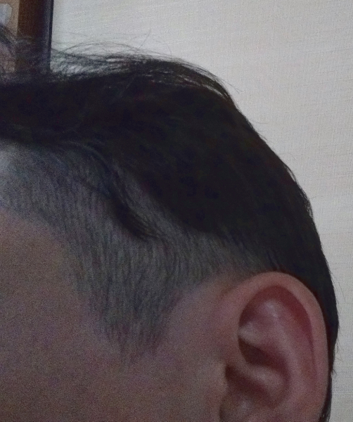 ツーブロ頼んで長さ聞かれたので「6ミリで」って言おうとしたのに何を思ったのか「3ミリ」って答えてしまった結果がこれ・・・orz
こっからフェードカットにしたい・・・。 