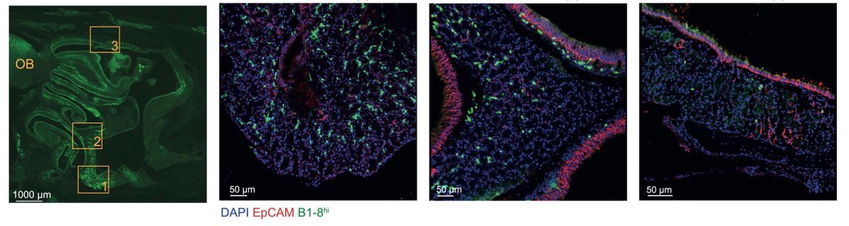What is the target organ of NALT B cells? Our imaging analysis of the upper airways revealed that antigen-specific B cells reside in the turbinate region and acinar glands. These are plasma cells expressing Blimp-1 and secreting IgA.