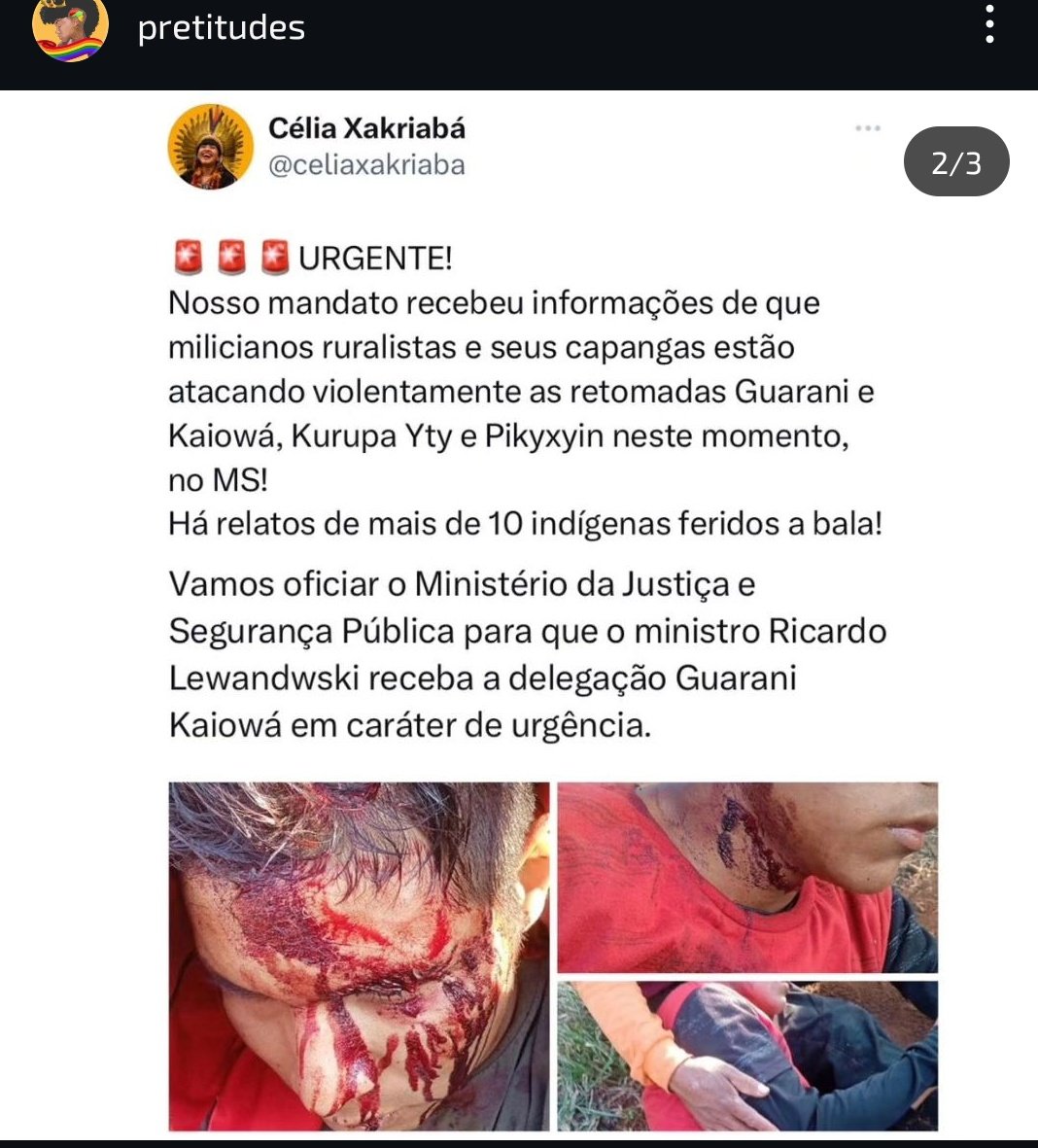 O agro que é tóxico segue mat4ndo indígenas