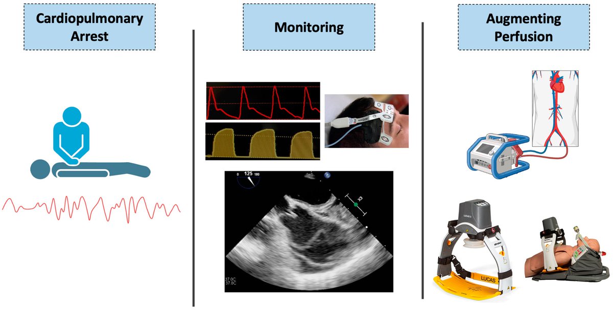 Today's Paper of the Day is on physiology-guided resuscitation: monitoring and augmenting perfusion during cardiopulmonary arrest
criticalcarereviews.com/latest-evidenc…

Join us to read 1 paper per day and stay up-to-date as we cover the spectrum of critical care across 2024