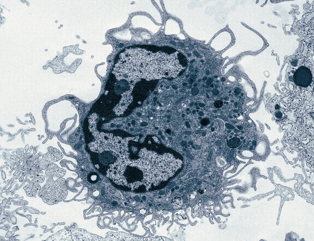 Thomas Marichal (@gigaipl) on Twitter photo 💥 Publication Alert 💥 I am thrilled to announce the publication of our latest research , which characterizes novel Ly6G+ repair-promoting lung macrophages post-injury.
<a href="/frsFNRS/">F.R.S.-FNRS</a> <a href="/ERC_Research/">European Research Council (ERC)</a> <a href="/WELRI_asbl/">WEL Research Institute</a> <a href="/UniversiteLiege/">Université de Liège</a> <a href="/ULiegeRecherche/">ULiège Research & Innovation</a> <a href="/GIGA_ULiege/">GIGA-ULiège</a>
science.org/doi/10.1126/sc… 💥 Publication Alert 💥 I am thrilled to announce the publication of our latest research , which characterizes novel Ly6G+ repair-promoting lung macrophages post-injury.
<a href="/frsFNRS/">F.R.S.-FNRS</a> <a href="/ERC_Research/">European Research Council (ERC)</a> <a href="/WELRI_asbl/">WEL Research Institute</a> <a href="/UniversiteLiege/">Université de Liège</a> <a href="/ULiegeRecherche/">ULiège Research & Innovation</a> <a href="/GIGA_ULiege/">GIGA-ULiège</a>
science.org/doi/10.1126/sc…