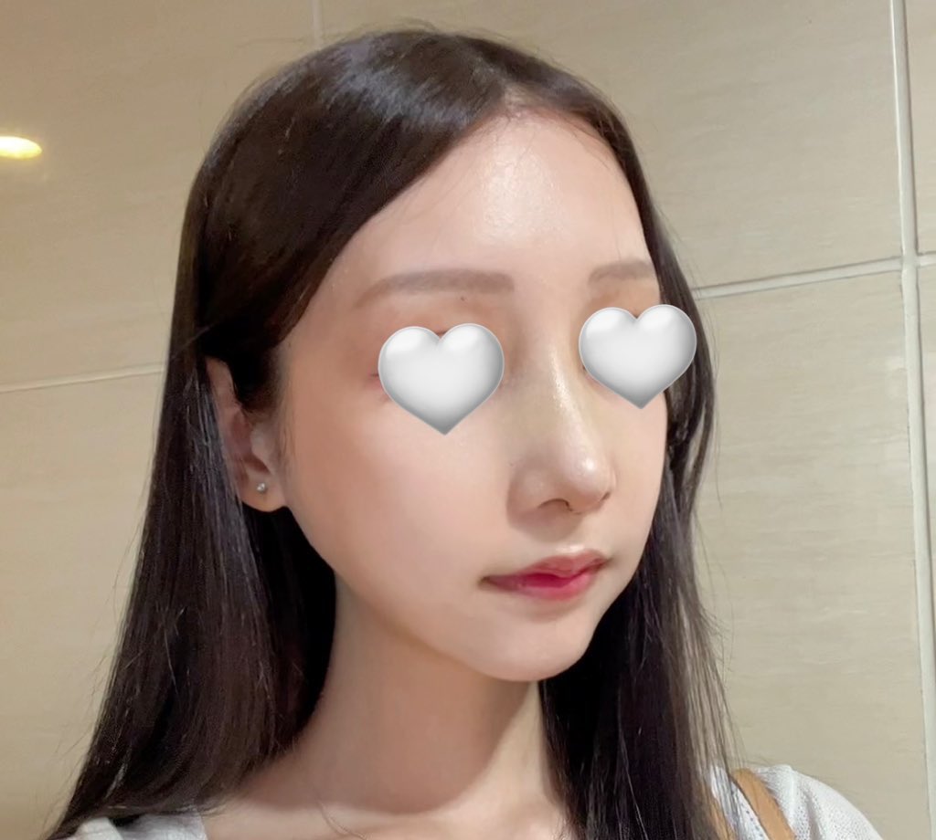 _unagi_una's tweet photo. 鼻フルdt9日目 正面から見るとまだ若干付け鼻感ある この顔が見慣れてないだけかもだけど🫠 https://t.co/ZZp41yCfmA