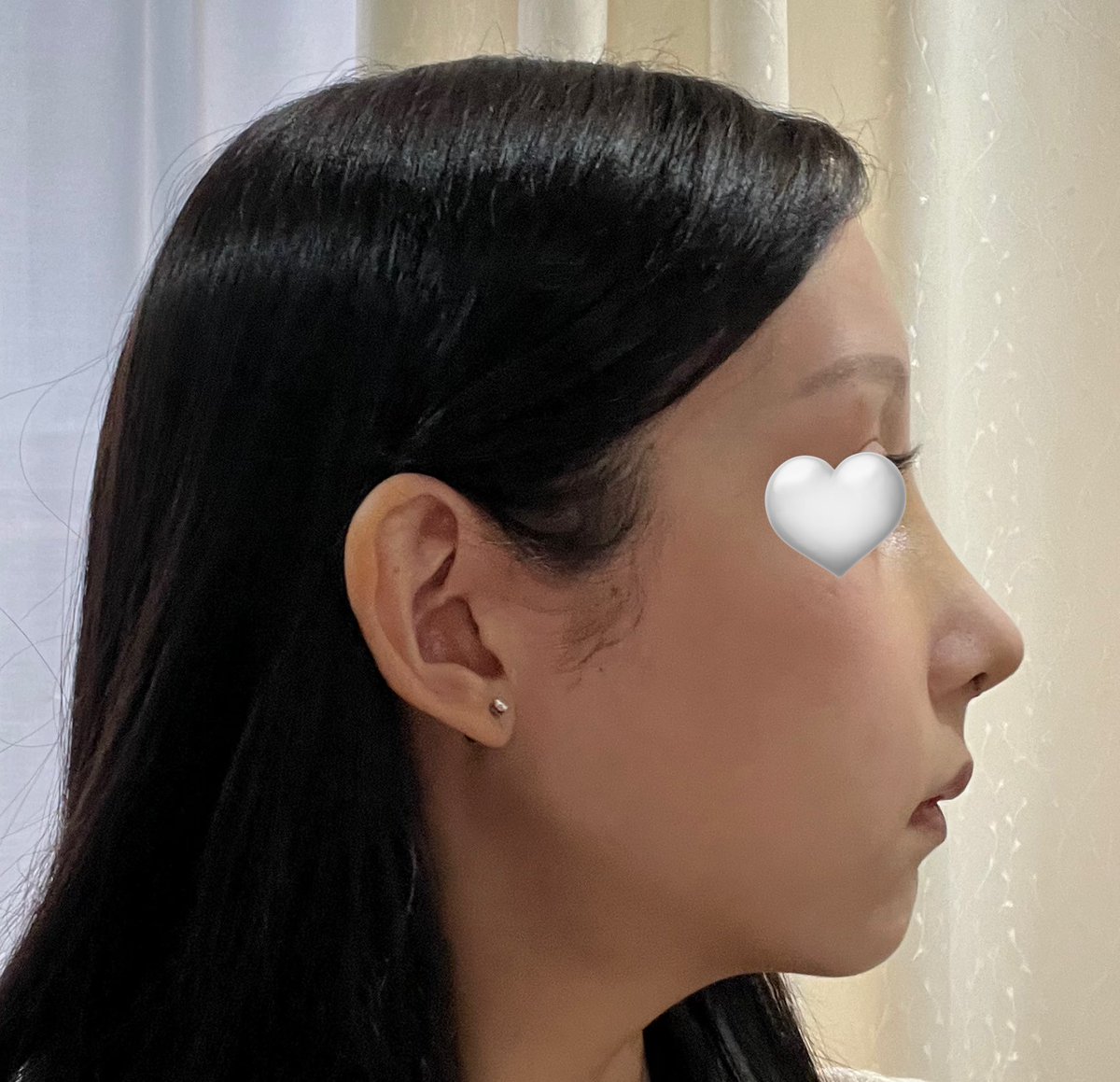 _unagi_una's tweet photo. 鼻フルdt9日目 正面から見るとまだ若干付け鼻感ある この顔が見慣れてないだけかもだけど🫠 https://t.co/ZZp41yCfmA