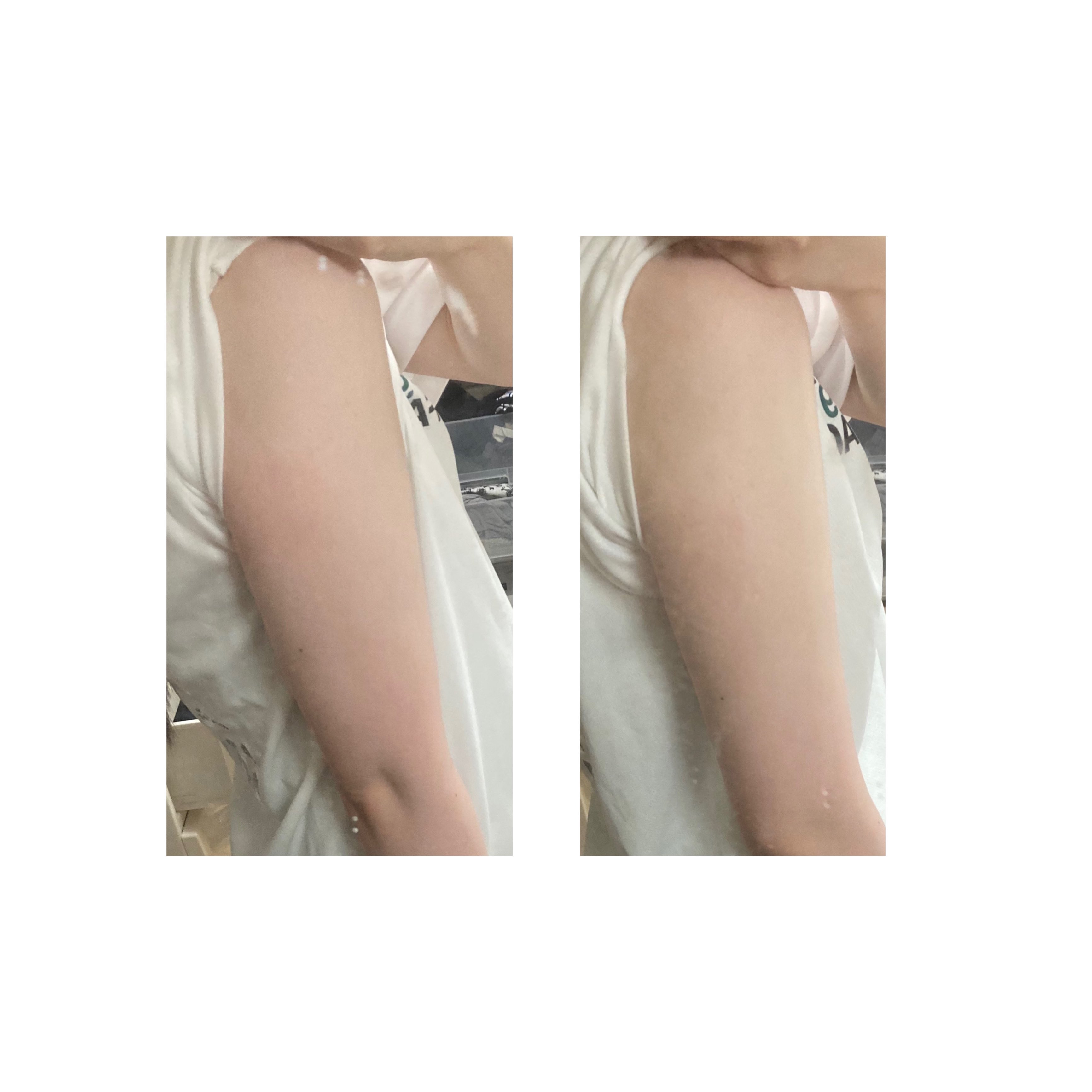 ぴ様美容セット（プランエス） mirari】 ミラリ2025サマーパック3種キット ｜Biople WEB STORE