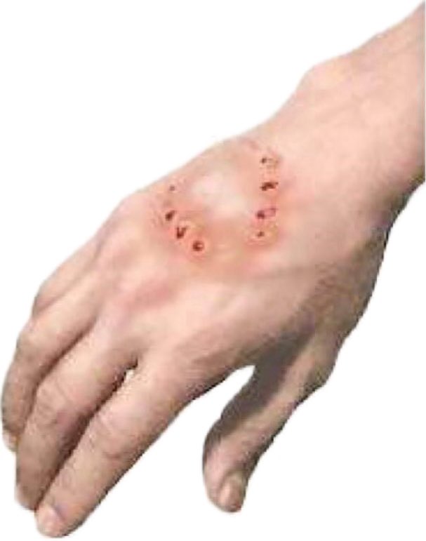 Oren Gottfried, MD tweet media