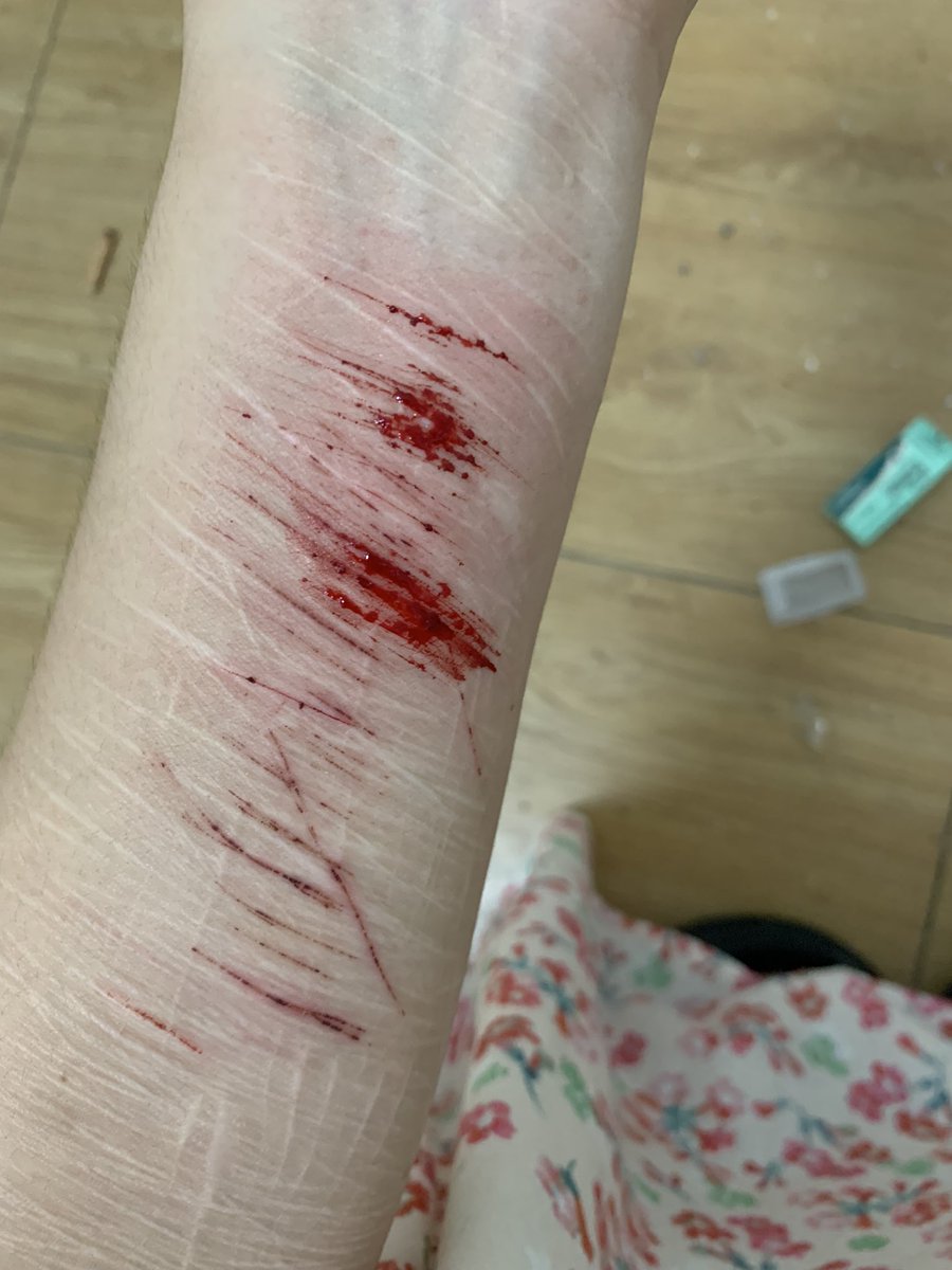 byebyeQi's tweet photo. 喜欢绵密的伤口，血珠凝固后再扣下来 https://t.co/0HNgQZTWGJ