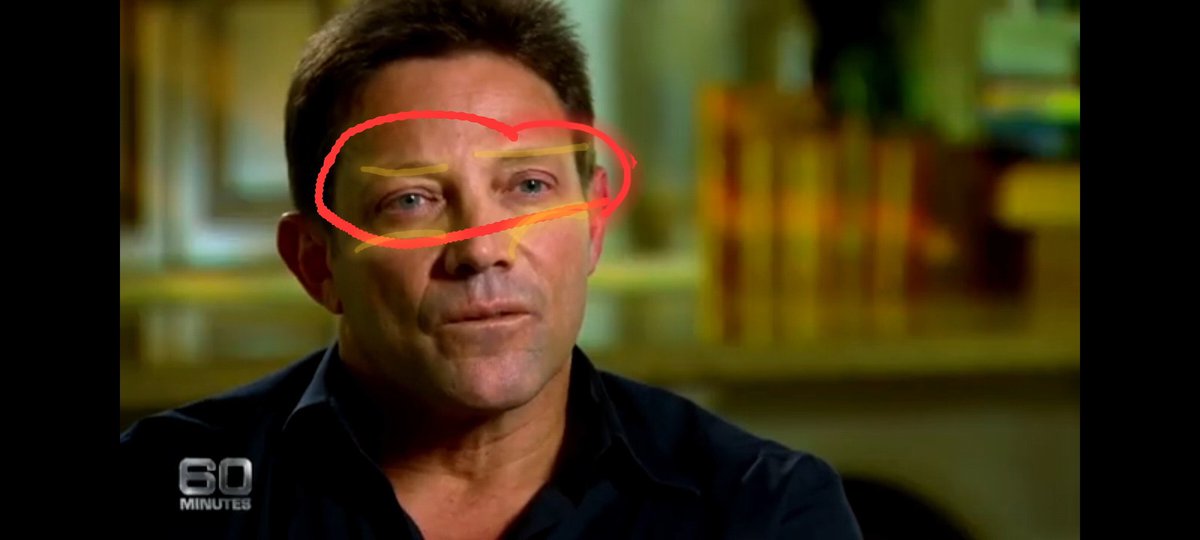 lostmales's tweet image. In the video, he's asked about his income. Before laughing it off and leaving the interview, you can see his eyes squint and his eye bags bulge. #BodyLanguage #SubtleSigns