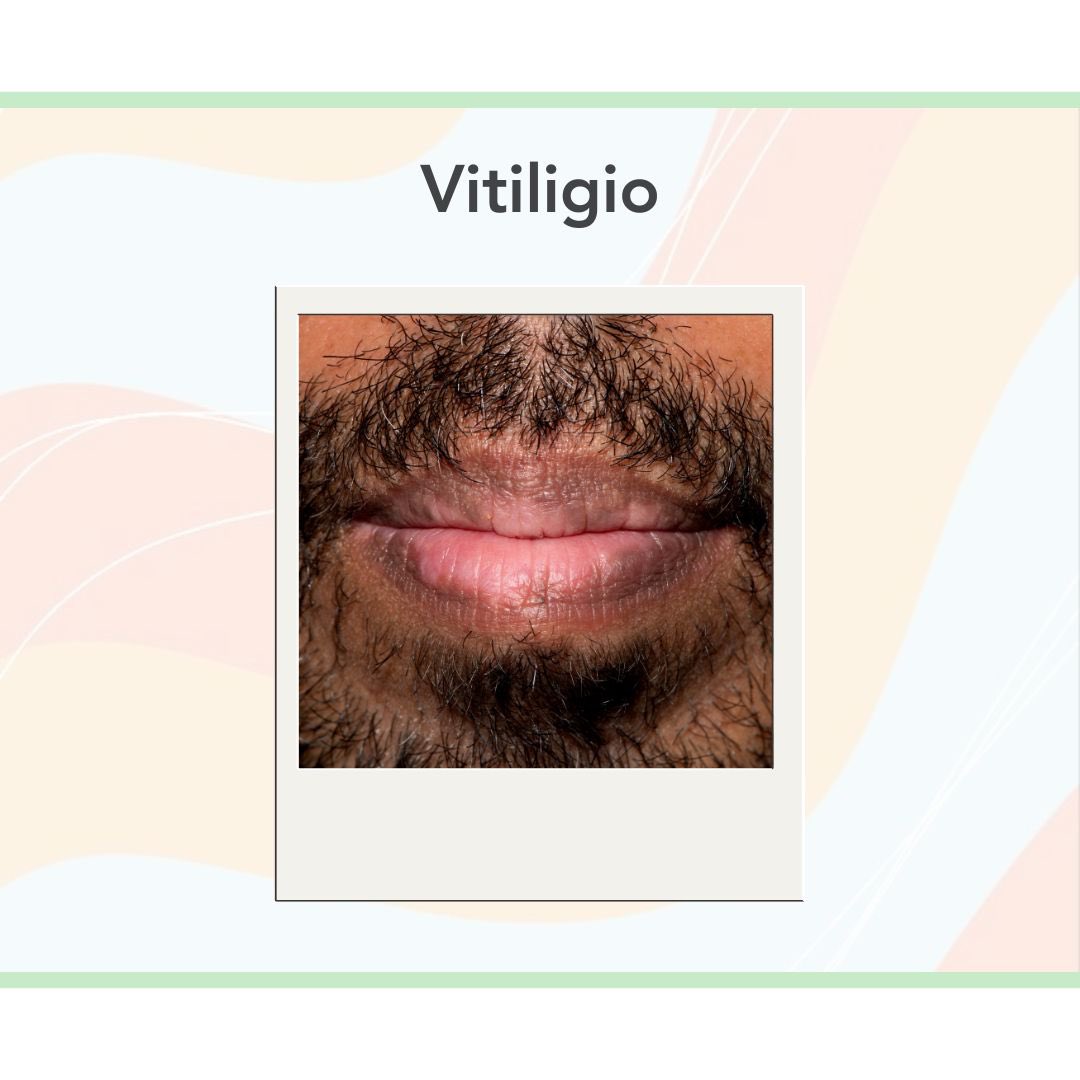 ReframeImages's tweet image. Some examples of what we have captured for strand 1📸 

#healthcare #equality #photography #medical