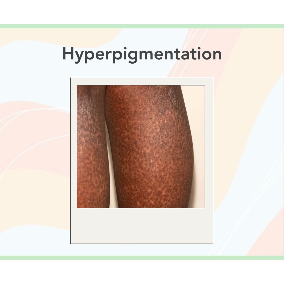ReframeImages's tweet image. Some examples of what we have captured for strand 1📸 

#healthcare #equality #photography #medical