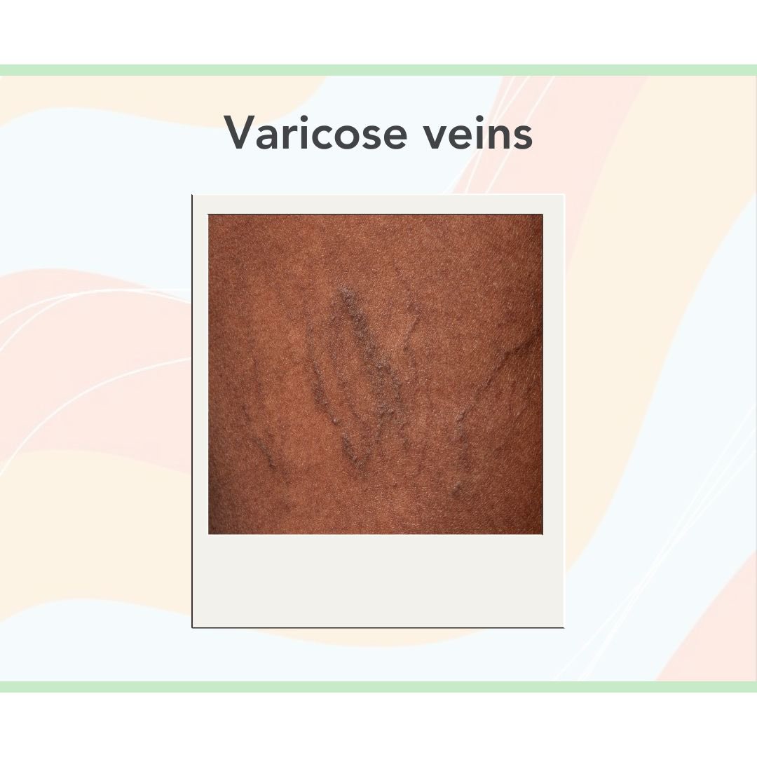 ReframeImages's tweet image. Some examples of what we have captured for strand 1📸 

#healthcare #equality #photography #medical