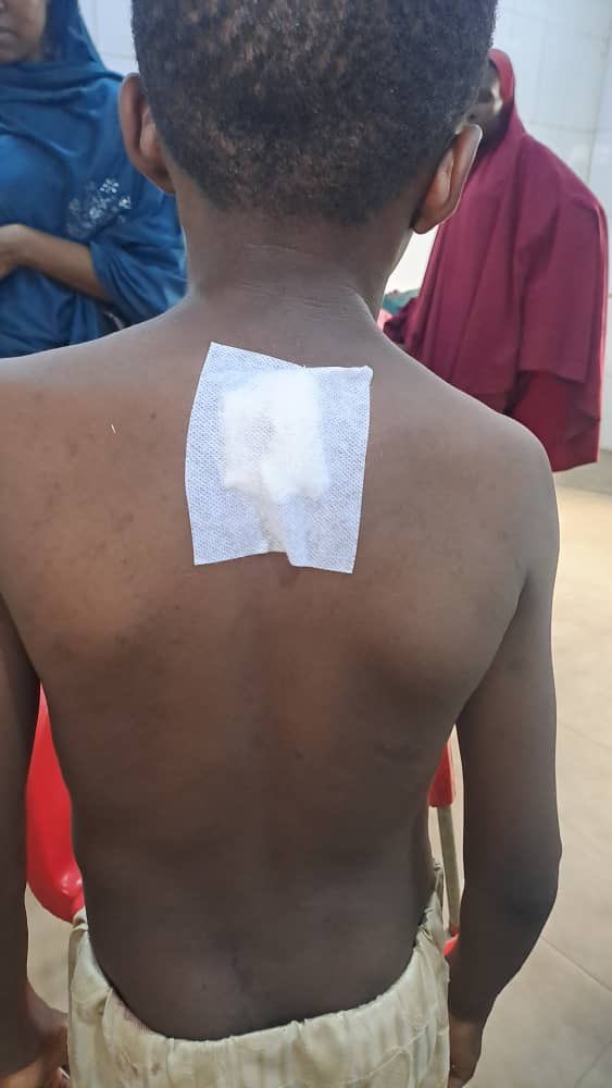 JaafarSJaafar's tweet photo. This Kano boy was hit by a stray bullet while sitting in the living room. #EndBadGovernace https://t.co/Ife5wyiE8I