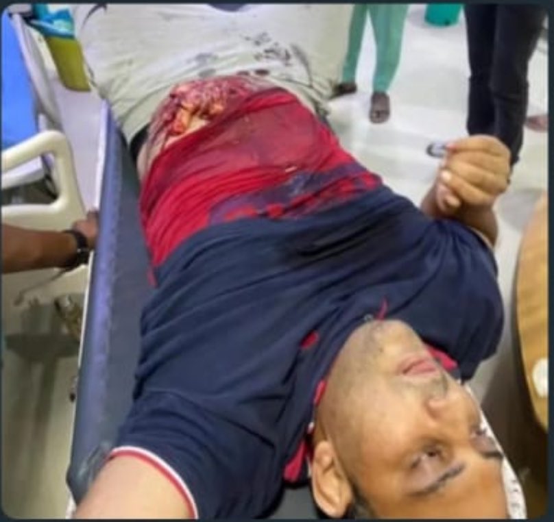 ocjain4's tweet image. दुःखद

सोनू सरपंच जी जिनको गौ रक्षा के दौरान गौ तस्करों ने गोली मार दी थी।

उनका इलाज चल रहा था,किंतु आज भाई जिंदगी की जंग हार गए

मेवात में कुछ दिन पहले गौ तस्करों ने इन्हें गोली मार दी थी

गौ माता भाई की आत्मा को अपने चरणों में स्थान दे 🙏