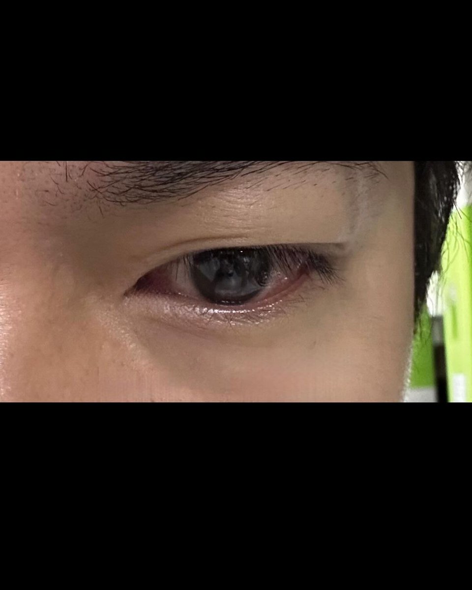 solidlmhph's tweet photo. @ActorLeeMinHo IG update 13 minutes ago.
더위조심 그리고 눈병조심 
(Be careful of the heat and eye disease)
Lee Minho (이민호) 
@actorleeminho @myment_official
#LeeMinHo leeminho film 
https://t.co/QQWkoKk7jq
#PachinkoS2 https://t.co/nvWRMOYHwg