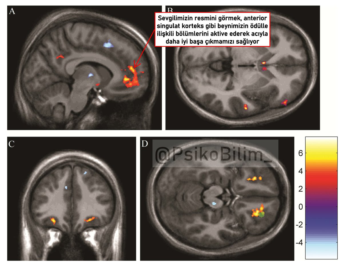 Sevgilimizin resminin bile ağrı kesici etkisi var. Sevgilimizin resmini görmek beynimizdeki ödül merkezlerini aktive ederek ağrımızı azaltıyor.