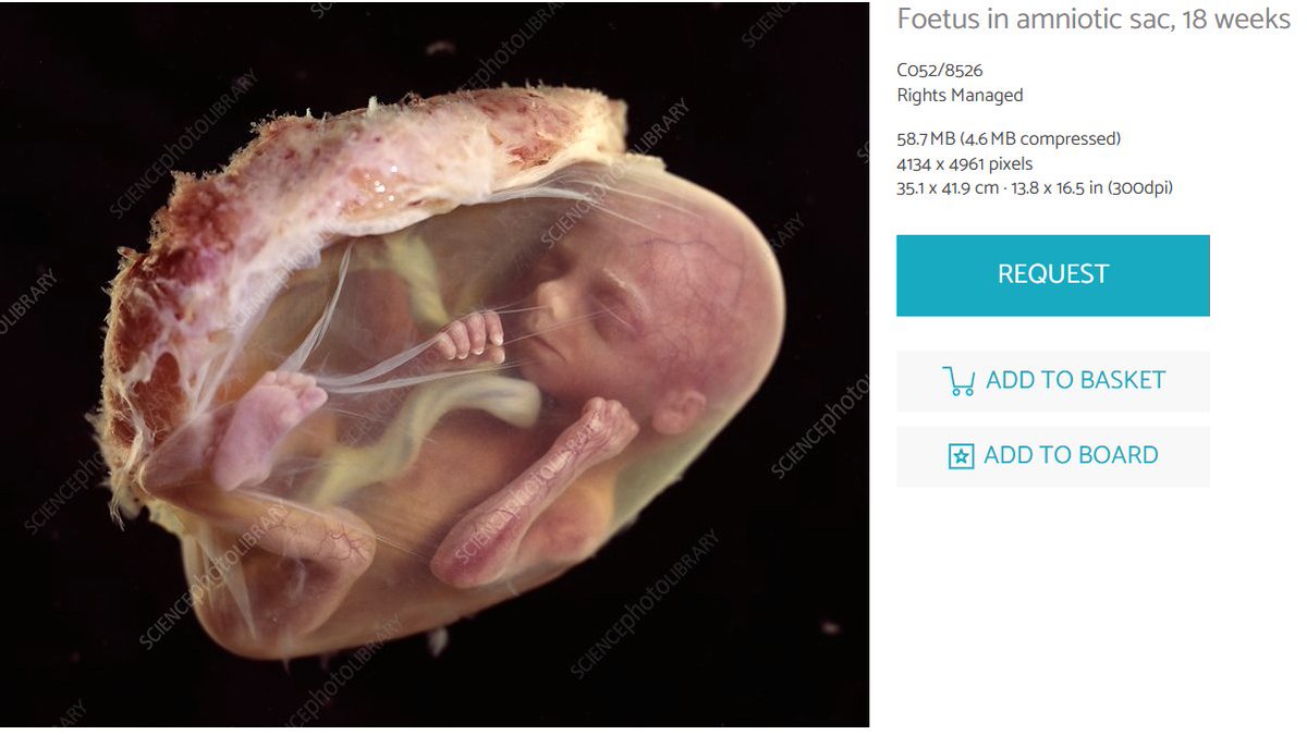 Si la vida de la madre llega a estar en peligro, es perfectamente legal hacer un parto prematuro.

El reclamo por aborto no es preservar la vida de la madre, sino quitarle la vida al hijo.