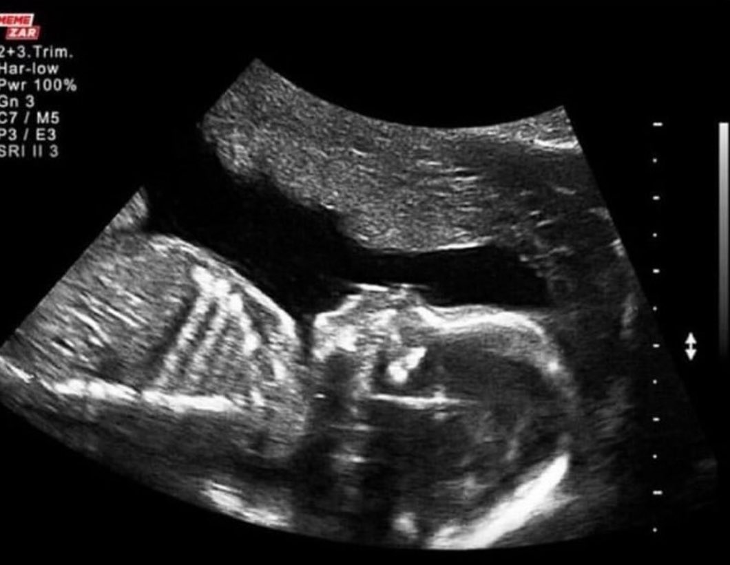 My son in 1992 (black &amp; white) wasting time sleeping instead of buying Nvidia stock