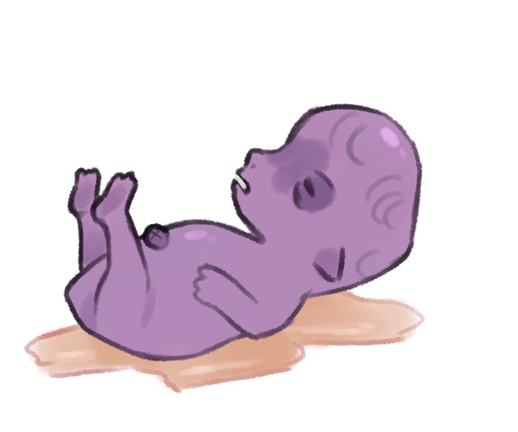 drawing your oc as an ugly baby >>>>>>>>>>>>>>>