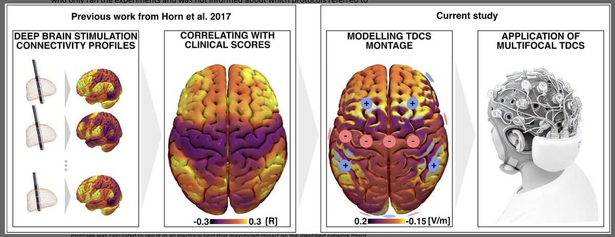 Michael Okun (@michaelokun) on Twitter photo Can we non-invasively target a network identified by DBS to be potentially effective for Parkinson's? You bet we can and Goede, Horn and colleagues show us the path <a href="/MDJ_Journal/">Movement Disorders Journal</a> in a new prospective, randomized, double-blinded, crossover trial in 21 folks.
…mentdisorders.onlinelibrary.wiley.com/doi/10.1002/md… Can we non-invasively target a network identified by DBS to be potentially effective for Parkinson's? You bet we can and Goede, Horn and colleagues show us the path <a href="/MDJ_Journal/">Movement Disorders Journal</a> in a new prospective, randomized, double-blinded, crossover trial in 21 folks.
…mentdisorders.onlinelibrary.wiley.com/doi/10.1002/md…