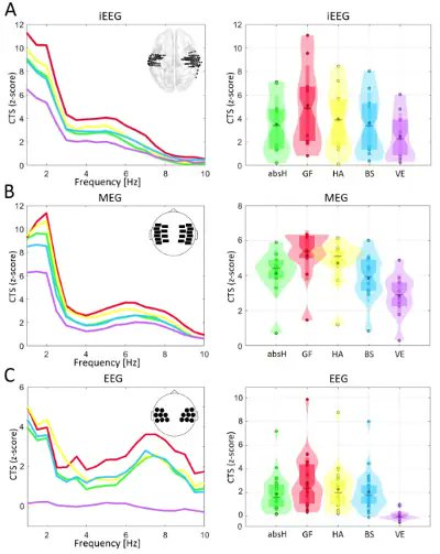 insight_neuro's tweet image. On the speech envelope in the cortical tracking of speech EEG-ERP EEG-fMRI NIRS-fNIRS

#EEGMicrostates
#AttentionFocus
#BrainDynamics
#CognitiveStates
#NeuralPatterns
#MentalMapping
#NeuralMarkers
#BrainActivity
#Neurofeedback
#ConsciousnessMapping

brainlatam.com/blog/iii-sympo…